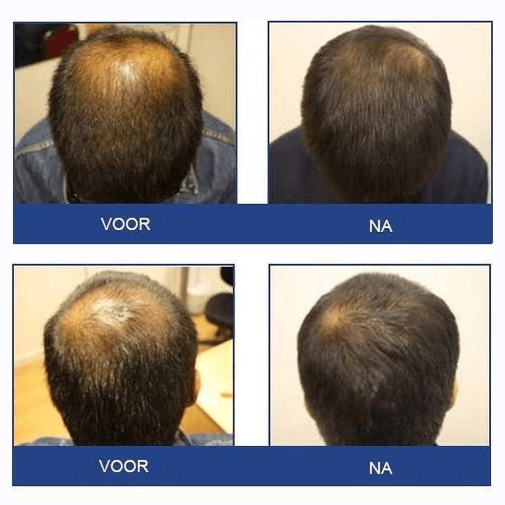 Haarspülung gegen Haarausfall für Männer (236 ml)